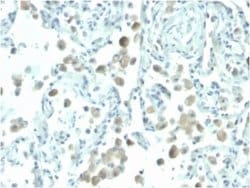 Mesothelin Antibody (MSLN/2131) - Azide and BSA Free, Novus Biologicals