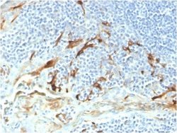 Mesothelin Antibody (MSLN/2131) - Azide and BSA Free, Novus Biologicals