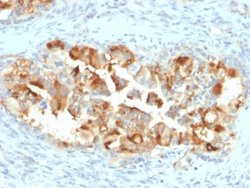 Mesothelin, Mouse anti-Human,Mouse,Rat, Clone: MSLN/2131, Novus Biologicals:Antibodies:Primary