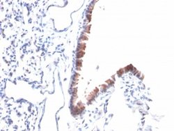 Mesothelin, Mouse anti-Human,Mouse,Rat, Clone: MSLN/2131, Novus Biologicals:Antibodies:Primary