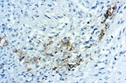 Mesothelin Antibody (YP158), Novus Biologicals 0.1 ml; Unconjugated:Antibodies,