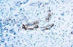 Mesothelin Antibody (YP158), Novus Biologicals 0.1 ml; Unconjugated:Antibodies,