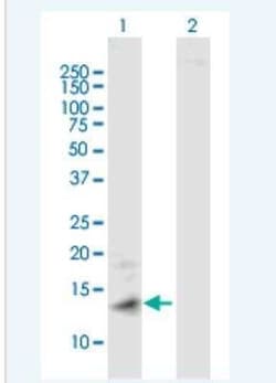 Metallothionein-1A Antibody, Novus Biologicals 50 &mu;g | Buy Online | Novus Biologicals | Fisher Scientific