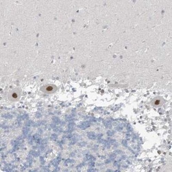 Methionine Aminopeptidase 1D/MAP1D Antibody, Novus Biologicals:Antibodies:Primary