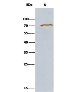 Methionine Aminopeptidase 2/METAP2 Antibody, Novus Biologicals 100 &mu;g,