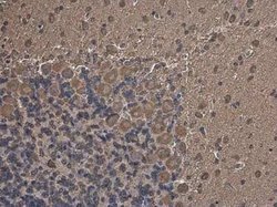 Methionyl tRNA synthetase Antibody, Novus Biologicals 100 &mu;g | Buy Online | Novus Biologicals | Fisher Scientific