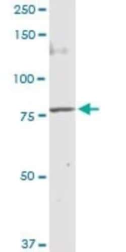 Methylmalonyl Coenzyme A mutase Antibody, Novus Biologicals 0.1 mg, Unconjugated:Antibodies,