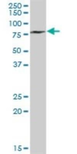 Methyltransferase like 3 Antibody, Novus Biologicals 0.05 mg | Buy Online | Novus Biologicals | Fisher Scientific