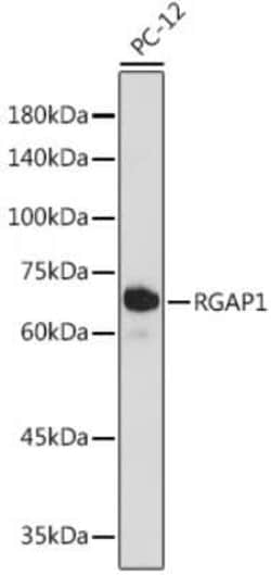 MgcRacGAP/RACGAP1 Rabbit anti-Human, Mouse, Rat, Clone: 10F7U6, Novus Biologicals