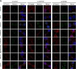 MgcRacGAP/RACGAP1 Antibody (1G6), Novus Biologicals 0.1 mg | Buy Online | Novus Biologicals | Fisher Scientific