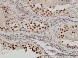 MgcRacGAP/RACGAP1 Antibody (1G6), Novus Biologicals 0.1 mg | Buy Online | Novus Biologicals | Fisher Scientific