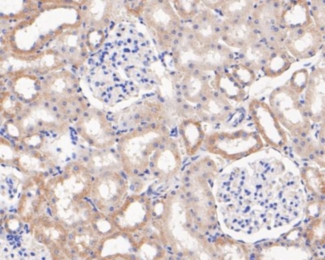 microsomal glutathione s-transferase 1 antibody Microsomal Glutathione S-transferase 1 Mouse anti-Human, Mouse, Rat,  Zebrafish, Clone: 14H2, Novus Biologicals 100 μL | Buy Online | Novus  Biologicals