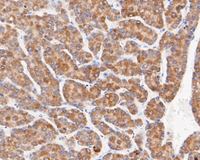 microsomal glutathione s-transferase 1 antibody Microsomal Glutathione S-transferase 1 Mouse anti-Human, Mouse, Rat,  Zebrafish, Clone: 14H2, Novus Biologicals 100 μL | Buy Online | Novus  Biologicals