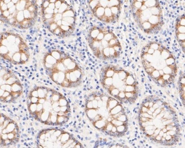 microsomal glutathione s-transferase 1 antibody Microsomal Glutathione S-transferase 1 Mouse anti-Human, Mouse, Rat,  Zebrafish, Clone: 14H2, Novus Biologicals 100 μL | Buy Online | Novus  Biologicals