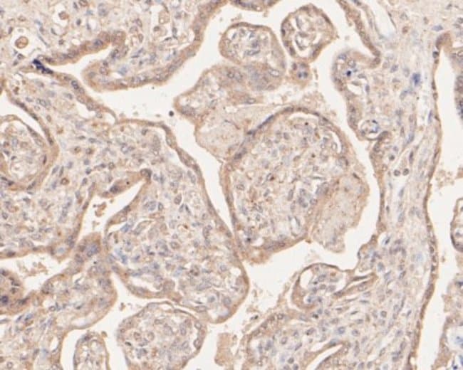 microsomal glutathione s-transferase 1 antibody Microsomal Glutathione S-transferase 1 Mouse anti-Human, Mouse, Rat,  Zebrafish, Clone: 14H2, Novus Biologicals 100 μL | Buy Online | Novus  Biologicals