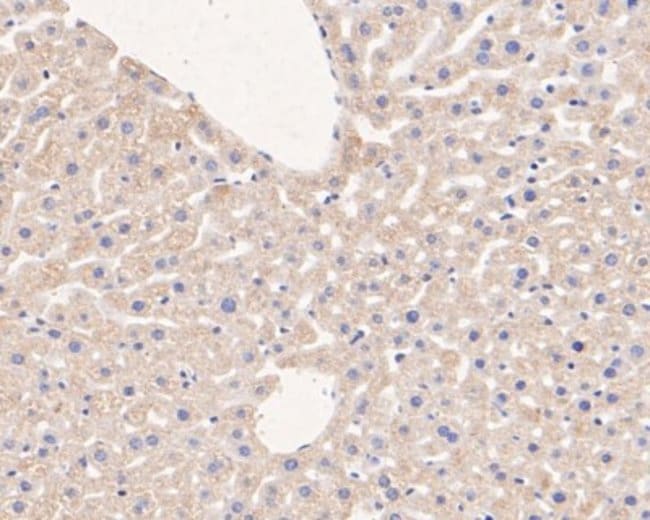 microsomal glutathione s-transferase 1 antibody Microsomal Glutathione S-transferase 1 Mouse anti-Human, Mouse, Rat,  Zebrafish, Clone: 14H2, Novus Biologicals 100 μL | Buy Online | Novus  Biologicals