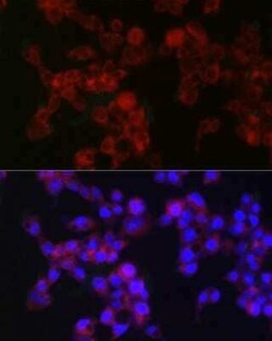 Microsomal Glutathione S-transferase 1 Rabbit anti-Human, Mouse, Rat, Clone: