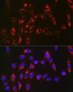 Microsomal Glutathione S-transferase 1 Rabbit anti-Human, Mouse, Rat, Clone: