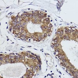 Microsomal Glutathione S-transferase 1 Rabbit anti-Human, Mouse, Rat, Clone: