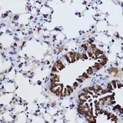Microsomal Glutathione S-transferase 1 Rabbit anti-Human, Mouse, Rat, Clone:
