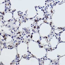 Microsomal Glutathione S-transferase 1 Rabbit anti-Human, Mouse, Rat, Clone: