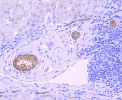 Midkine Antibody (JF096-5), Novus Biologicals 100&mu;L:Antibodies, Monoclonal