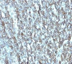 Migfilin Mouse anti-Human, Clone: FBLIM1/4600, Novus Biologicals 20 &mu;g;