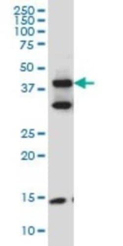 Migfilin Antibody (5E11), Novus Biologicals 0.1 mg | Buy Online | Novus Biologicals | Fisher Scientific
