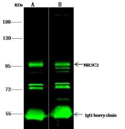 Mineralocorticoid R/NR3C2 Antibody, Novus Biologicals:Antibodies:Primary