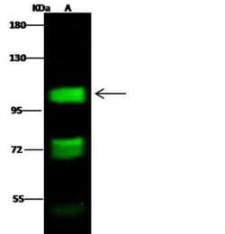 Mineralocorticoid R/NR3C2 Antibody, Novus Biologicals:Antibodies:Primary