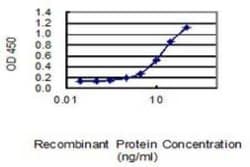 Mitofusin 2 Antibody (6A8), Novus Biologicals 0.1 mg | Buy Online | Novus Biologicals | Fisher Scientific