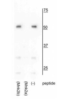 MNK2 Antibody - a Isoform, Novus Biologicals 100&mu;L:Antibodies, Polyclonal