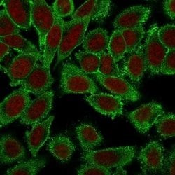 Moesin Antibody (MSN/491), Novus Biologicals 0.5mL; Unlabeled:Antibodies,