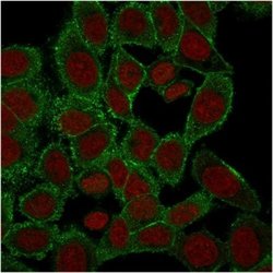 Moesin Antibody (rMSN/492) - Azide and BSA Free, Novus Biologicals 100 &mu;g | Buy Online | Novus Biologicals | Fisher Scientific