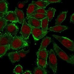 Moesin Antibody (MSN/492), Novus Biologicals 0.1mg; Unlabeled:Antibodies,