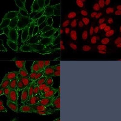 Moesin Antibody (MSN/493), Novus Biologicals 0.02mg; Unlabeled:Antibodies,