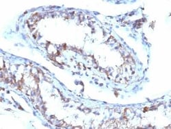 Moesin Antibody (MSN/493), Novus Biologicals 0.02mg; Unlabeled:Antibodies,