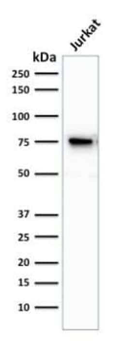 Moesin Antibody (MSN/493), Novus Biologicals 0.02mg; Unlabeled:Antibodies,