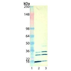 Mono- and polyubiquitinylated conjugates Mouse, Clone: UBCJ2, Novus Biologicals 500 &mu;g | Buy Online | Novus Biologicals | Fisher Scientific