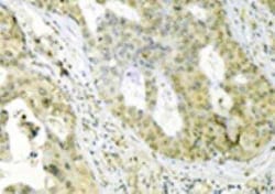 GRP75/HSPA9B/Mortalin Antibody (30A5), Novus Biologicals:Antibodies:Primary