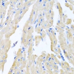 Motilin Antibody - BSA Free, Novus Biologicals:Antibodies:Primary Antibodies