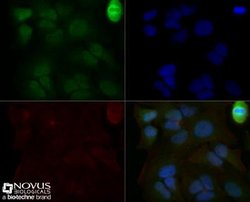 Mre11 Antibody (15B8.1E7.6) - BSA Free, Novus Biologicals 0.1 mg | Buy Online | Novus Biologicals | Fisher Scientific