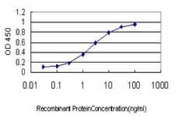 MuRF1/TRIM63 Antibody (6G6), Novus Biologicals 0.1 mg; Unconjugated:Antikörper