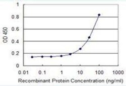 MuSK Antibody (4C12), Novus Biologicals 0.1 mg | Buy Online | Novus Biologicals | Fisher Scientific