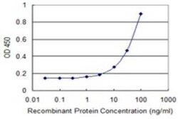 MuSK Antibody (4E5), Novus Biologicals 0.1 mg | Buy Online | Novus Biologicals | Fisher Scientific