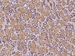 Mus81 Antibody, Novus Biologicals:Antibodies:Primary Antibodies