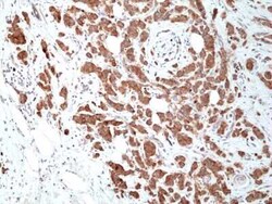 Musashi-2 Rabbit anti-Human, Clone: RM422, Novus Biologicals 25 &mu;g | Buy Online | Novus Biologicals | Fisher Scientific