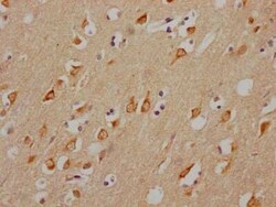 Muscarinic Acetylcholine Receptor M3/CHRM3 Antibody (2D4), Novus Biologicals