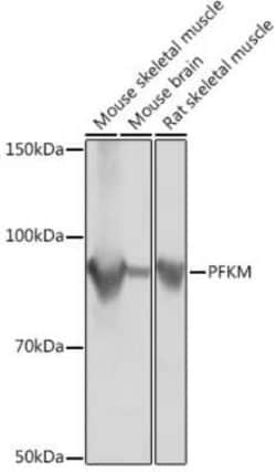 Muscle Phosphofructokinase/PFKM/PFK-1 Rabbit anti-Human, Mouse, Rat, Clone: