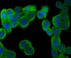 Muscle Phosphofructokinase/PFKM/PFK-1 Rabbit anti-Human, Mouse, Rat, Clone: